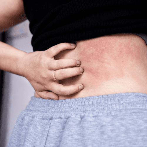 Our Services 19 Skin & Allergy