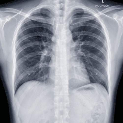 Our Services 7 X-Ray